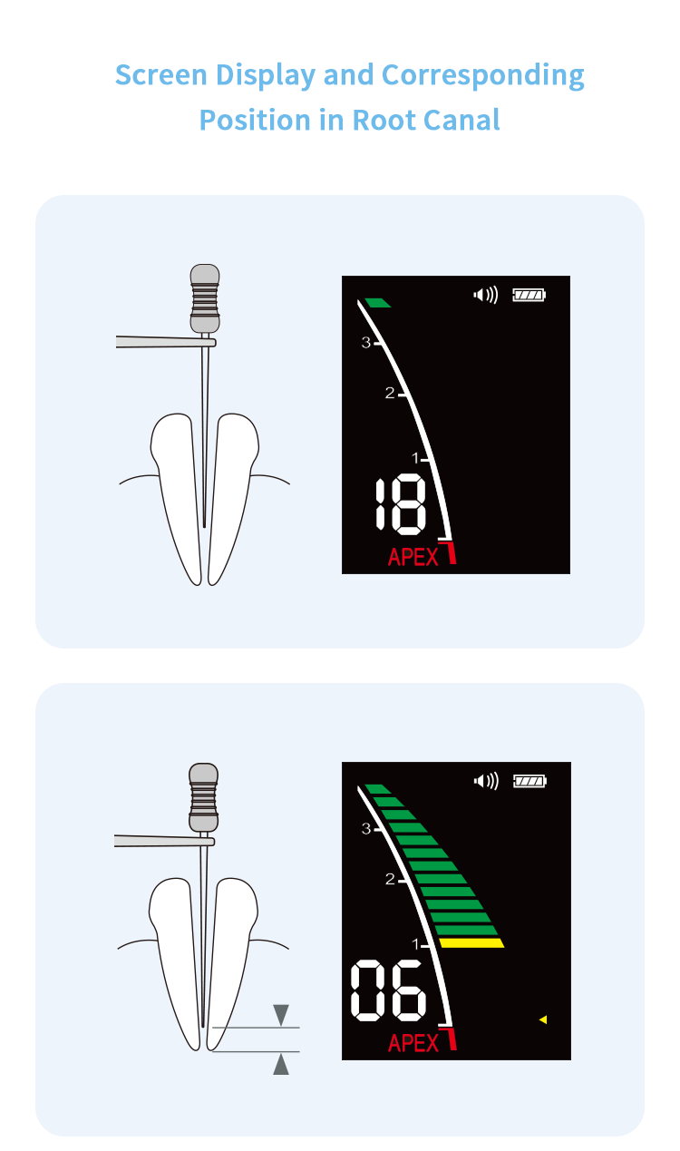 Pro-PEX (APEX LOCATOR) - Image 9