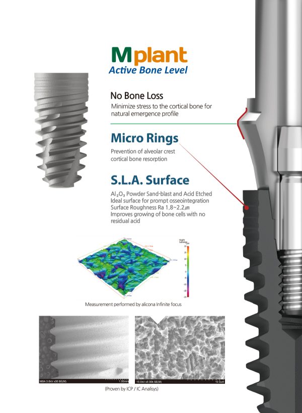 M Plant Implants - Image 2